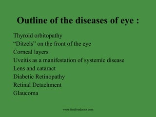 Outline of the diseases of eye : ,[object Object],[object Object],[object Object],[object Object],[object Object],[object Object],[object Object],[object Object],www.freelivedoctor.com 