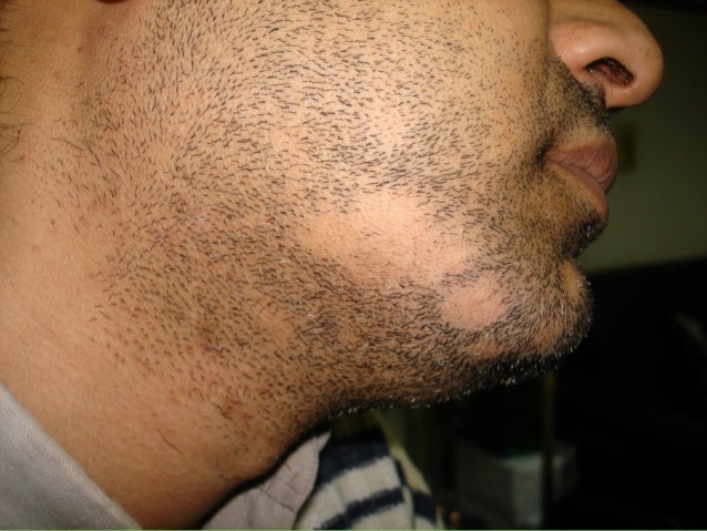 Dermatology 5th Year 1st Lecture Dr Darseem