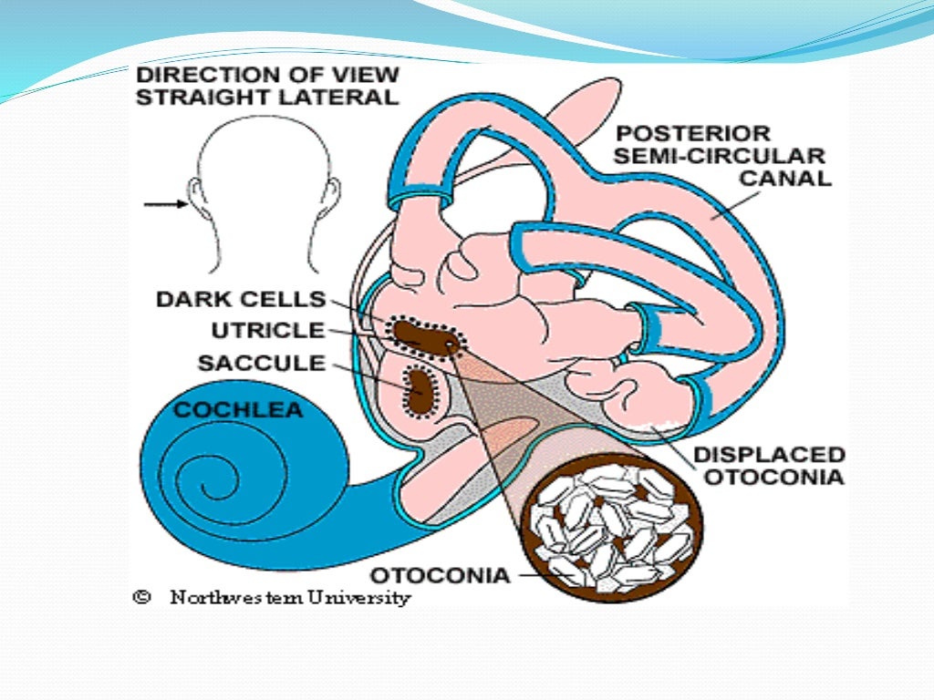 Diseases of the inner ear