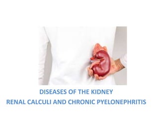 DISEASES OF THE KIDNEY
RENAL CALCULI AND CHRONIC PYELONEPHRITIS
 