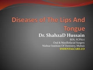 Dr. ShahzaD Hussain
BDS, FCPS(r)
Oral & Maxillofacial Surgery
Nishtar Institute Of Dentistry, Multan
SNDENTALCARE.CO
 