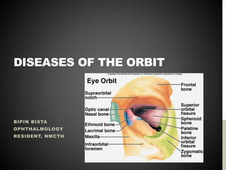DISEASES OF THE ORBIT
BIPIN BISTA
OPHTHALMOLOGY
RESIDENT, NMCTH
 