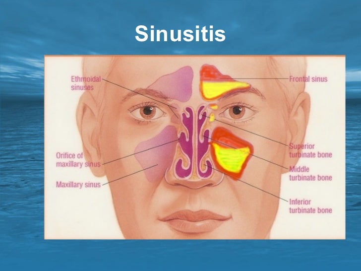 paranasal sinuses