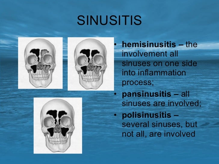 Diseases of the paranasal sinuses.