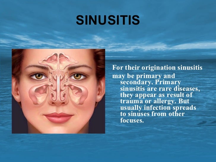 PARANASAL SINUS DISEASE PDF PARANASAL SINUS DISEASE PDF
