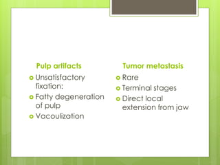 Pulp artifacts
 Unsatisfactory
fixation:
 Fatty degeneration
of pulp
 Vacoulization
Tumor metastasis
 Rare
 Terminal stages
 Direct local
extension from jaw
 