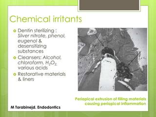 Chemical irritants
 Dentin sterilizing :
Silver nitrate, phenol,
eugenol &
desensitizing
substances
 Cleansers: Alcohol,
chloroform, H2O2,
various acids
 Restorative materials
& liners
Periapical extrusion of filling materials
causing periapical inflammation
M Torabinejd. Endodontics
 