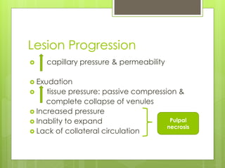 Lesion Progression
 capillary pressure & permeability
 Exudation
 tissue pressure: passive compression &
complete collapse of venules
 Increased pressure
 Inablity to expand
 Lack of collateral circulation
Pulpal
necrosis
 