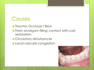 Causes
 Trauma: Occlusal / Blow
 Fresh amalgam filling: contact with cast
restoration
 Circulatory disturbances
 Local vascular congestion
 