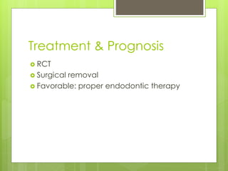 Treatment & Prognosis
 RCT
 Surgical removal
 Favorable: proper endodontic therapy
 