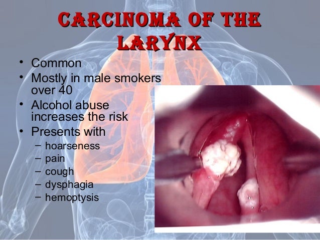 disease of the respiratory system essay Read this science term paper and over 87,000 other research documents asthma: disease of the respiratory system asthma: disease of the respiratory system. disease of the respiratory system essay Read this science term paper and over 87,000 other research documents asthma: disease of the respiratory system asthma: disease of the respiratory system.