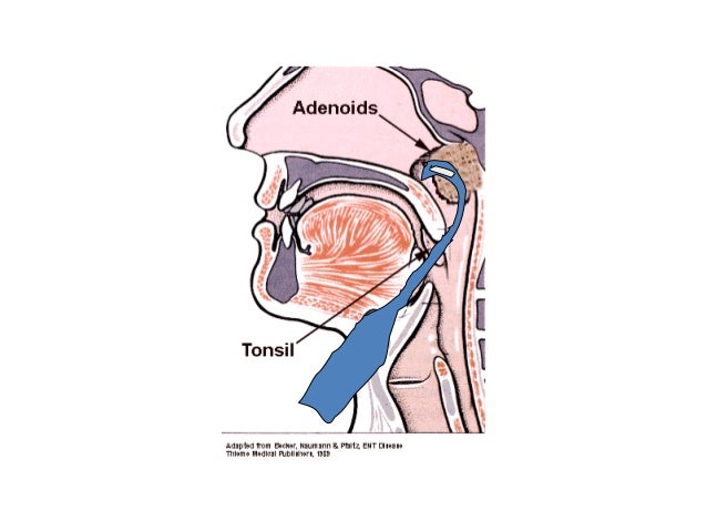 Diseases of the throat by Dr. Kavitha Ashok Kumar MSU Malaysia