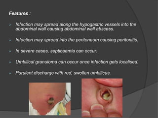DISEASES OF THE UMBILICUS pptx
