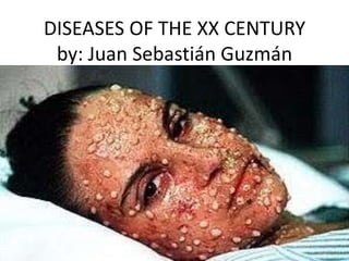 DISEASES OF THE XX CENTURY
 by: Juan Sebastián Guzmán
 