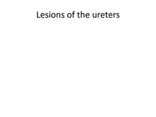 Lesions of the ureters
 