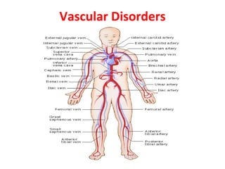 Vascular Disorders 