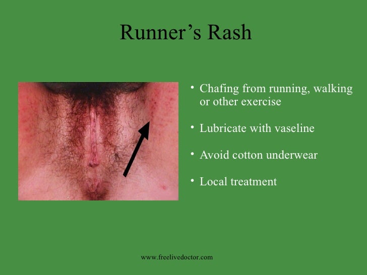 skin rash around mouth