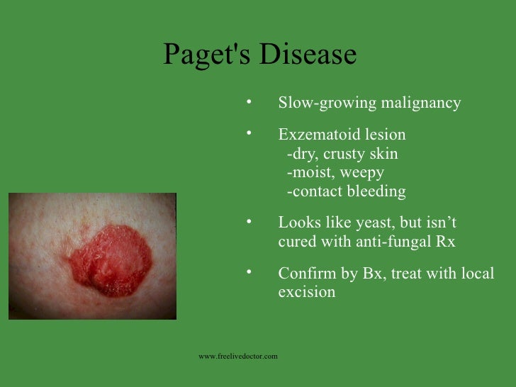 Chronic Pruritus: Clinics and Treatment - ncbi.nlm.nih.gov