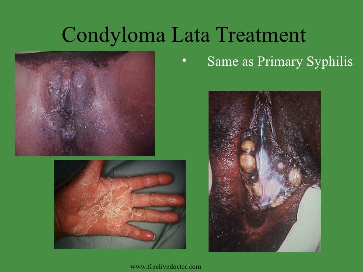 Recognizing Neoplastic Skin Lesions: A Photo Guide ...