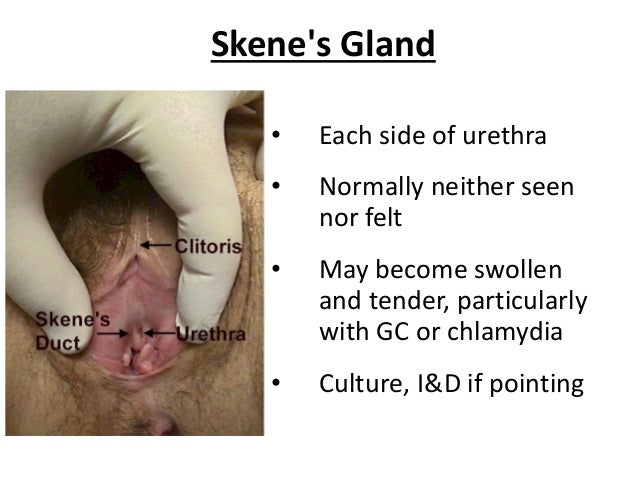 Diseases of vulva Diseases of vulva