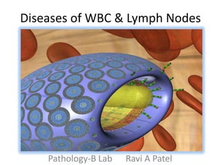Diseases of WBC & Lymph Nodes Pathology-B Lab      Ravi A Patel 
