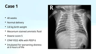Normal Fio2 Nicu Disease specific ventilation in neonates.pptx