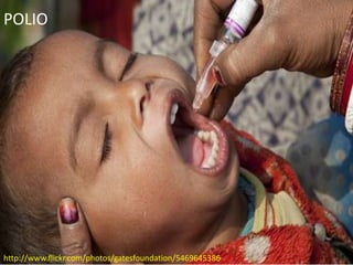 POLIO




http://www.flickr.com/photos/gatesfoundation/5469645386
 