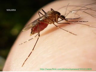 MALARIA




          http://www.flickr.com/photos/eyeweed/3553113835
 