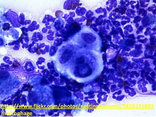 http://www.flickr.com/photos/nottinghamvets/5828221893
macrophage
 