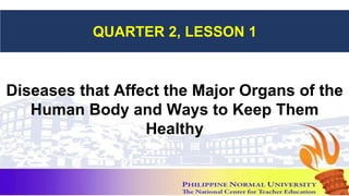 QUARTER 2, LESSON 1
Diseases that Affect the Major Organs of the
Human Body and Ways to Keep Them
Healthy
 