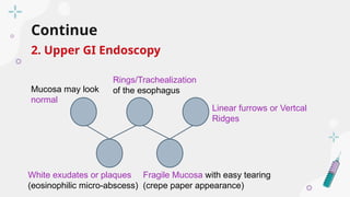 Tearing Ridges Comprehensive Overview of Eosinophilic Esophagitis: Diagnosis and ...