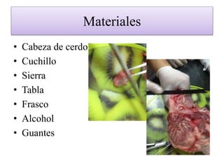 Materiales
• Cabeza de cerdo
• Cuchillo
• Sierra
• Tabla
• Frasco
• Alcohol
• Guantes
 