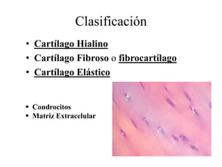 Clasificación
• Cartílago Hialino
• Cartílago Fibroso o fibrocartílago
• Cartílago Elástico
 Condrocitos
 Matriz Extracelular
 