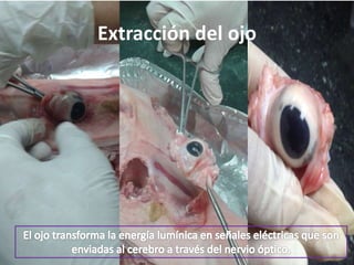 Extracción del ojo
 