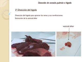 Disección de corazón, pulmón e hígado


3º Disección del hígado

Disección del hígado para apreciar las venas y sus ramificaciones.
Extracción de la vesícula biliar



                                                                     vesícula biliar
 