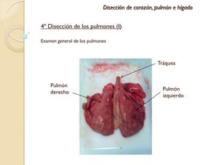 Disección de corazón, pulmón e hígado


4º Disección de los pulmones (I)

Examen general de los pulmones



                                                  Tráquea



    Pulmón
                                                    Pulmón
    derecho
                                                    izquierdo
 
