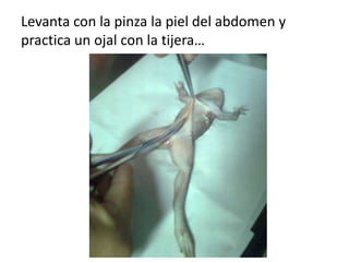 Levanta con la pinza la piel del abdomen y
practica un ojal con la tijera…
 