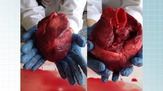 DISECCIÓN DE UN CORAZÓN, PROCEDIMIENTOS Y PASOS