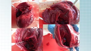 DISECCIÓN DE UN CORAZÓN, PROCEDIMIENTOS Y PASOS