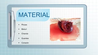 MATERIAL
 Pinzas
 Bisturí
 Charola
 Guantes
 Corazón
 