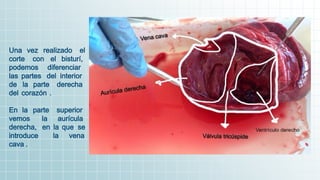 Una vez realizado el
corte con el bisturí,
podemos diferenciar
las partes del interior
de la parte derecha
del corazón .
En la parte superior
vemos la aurícula
derecha, en la que se
introduce la vena
cava .
 