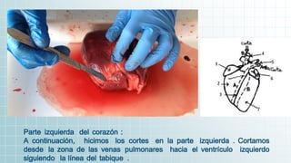 Parte izquierda del corazón :
A continuación, hicimos los cortes en la parte izquierda . Cortamos
desde la zona de las venas pulmonares hacia el ventrículo izquierdo
siguiendo la línea del tabique .
 
