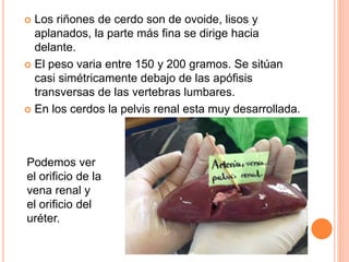 Disección de un riñón | PPTX