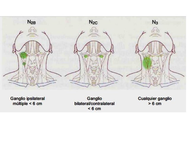 grupos ganglionares de cuello disecci 243 n ganglionar de cuello grupos ganglionares de cuello disecci 243 n ganglionar de cuello
