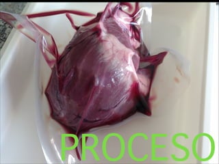 PROCESO
 