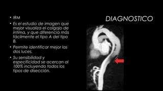 • IRM
• Es el estudio de imagen que
mejor visualiza el colgajo de
íntima, y que diferencia más
fácilmente el tipo A del tipo
B.
• Permite identificar mejor las
dos luces.
• Su sensibilidad y
especificidad se acercan al
100% incluyendo todos los
tipos de disección.

DIAGNOSTICO

 