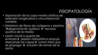FISIOPATOLOGÍA
• Separación de la capa media aórtica de
extensión longitudinal y circunferencial
variable.
• Deterioro de fibras de colágeno y elastina
degeneración quística necrosis
quística de la media
• Lesión inicial o puerta de
entradapresión hidrostática empuja
disecando las capaslumen falso que
se propaga oclusión de ramas de la
aorta.

 