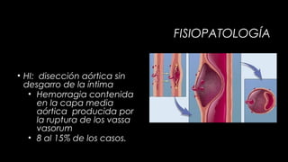 FISIOPATOLOGÍA

• HI: disección aórtica sin
desgarro de la íntima
• Hemorragia contenida
en la capa media
aórtica producida por
la ruptura de los vassa
vasorum
• 8 al 15% de los casos.

 