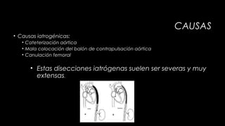 CAUSAS
• Causas iatrogénicas:
• Cateterización aórtica
• Mala colocación del balón de contrapulsación aórtica
• Canulación femoral

• Estas disecciones iatrógenas suelen ser severas y muy
extensas.

 
