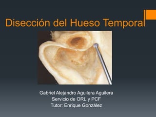 Disección del Hueso Temporal
Gabriel Alejandro Aguilera Aguilera
Servicio de ORL y PCF
Tutor: Enrique González
 